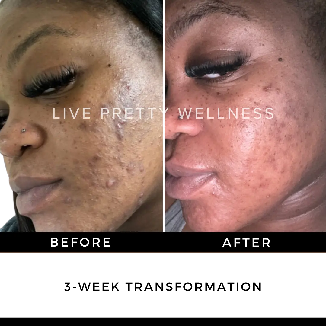 3-Week Transformation