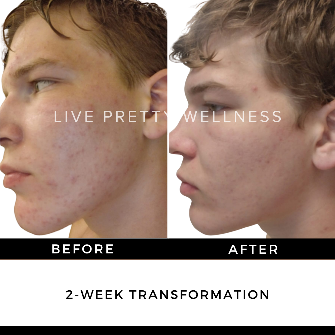 2-Week Transformation