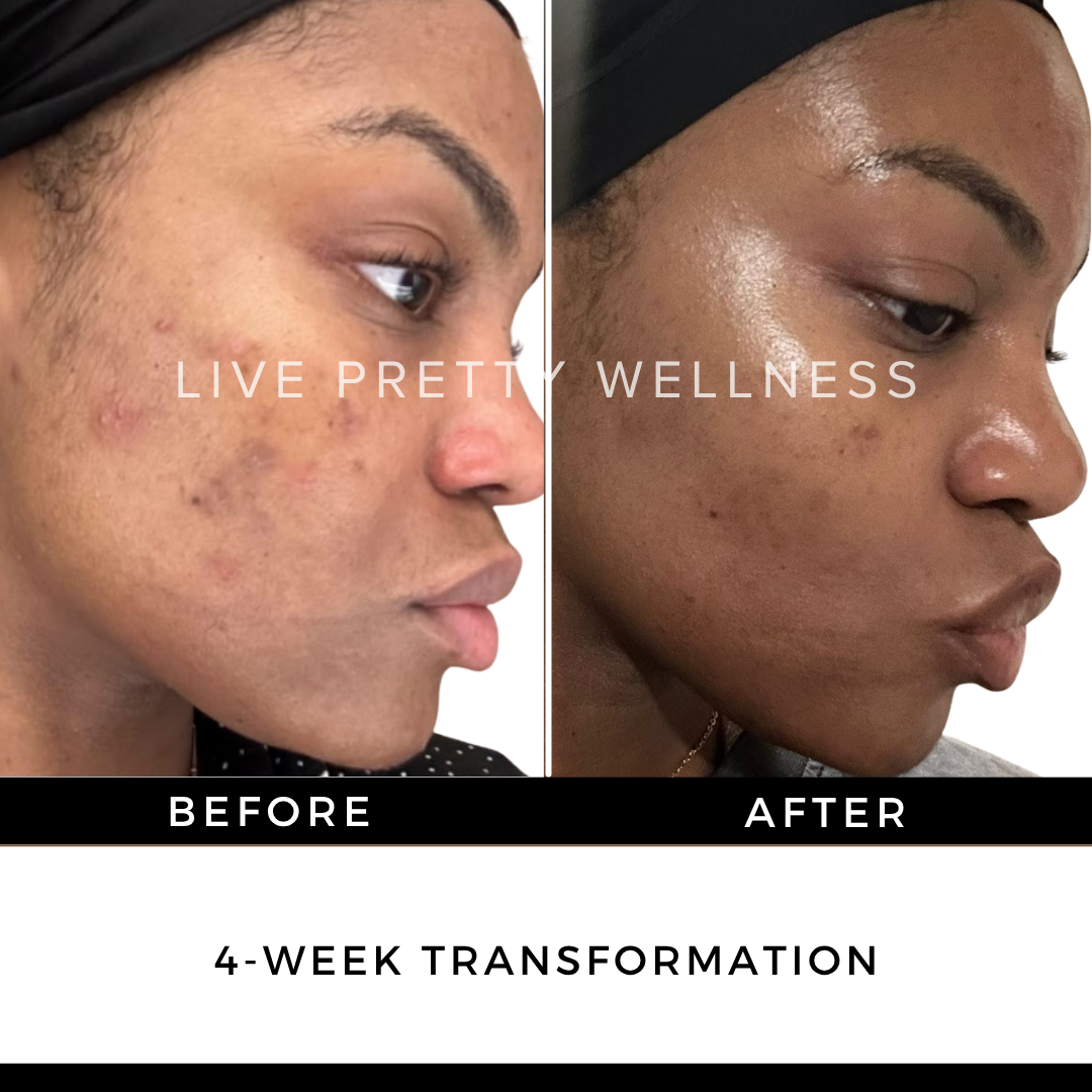 4-Week Transformation