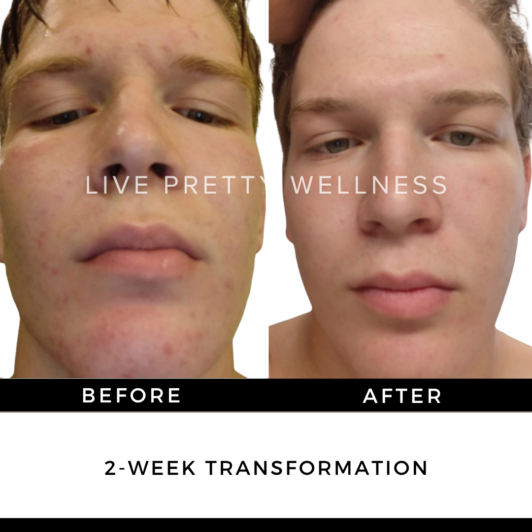 2-Week Transformation