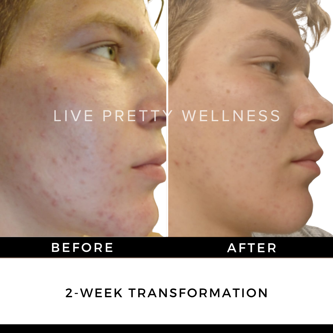 2-Week Transformation