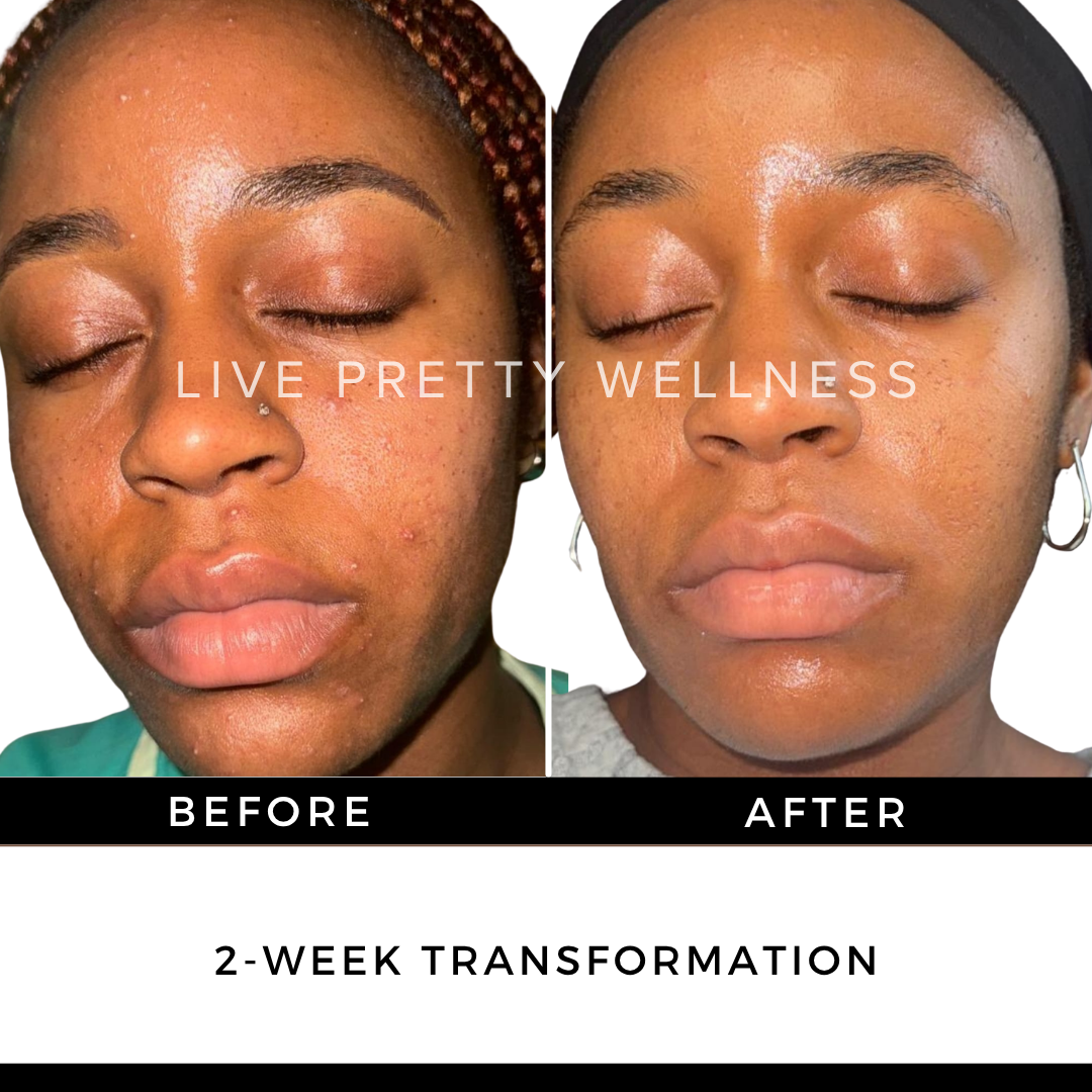 2-Week Transformation