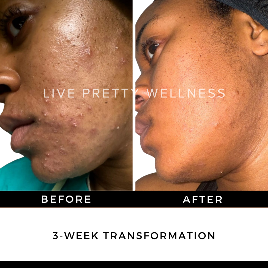 3-Week Transformation