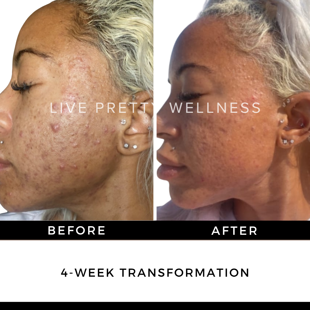 4-Week Transformation