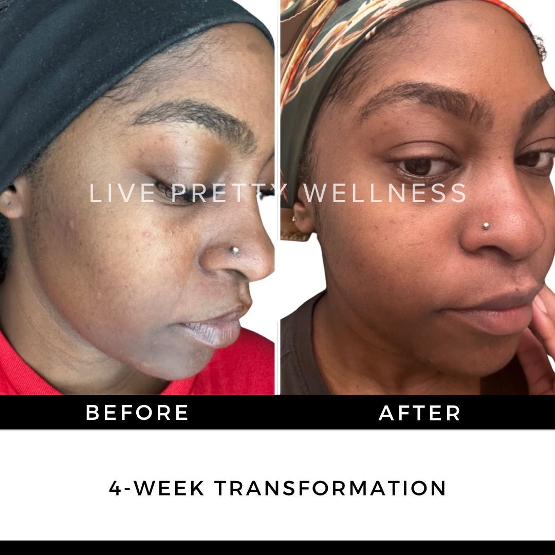 4-Week Transformation