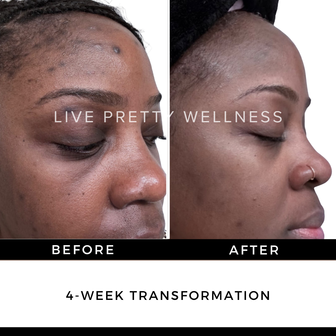 4-Week Transformation