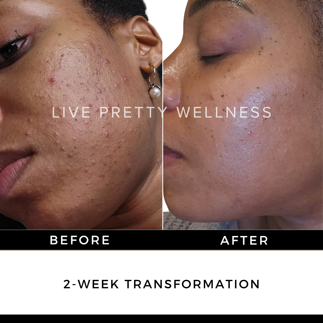 2-Week Transformation