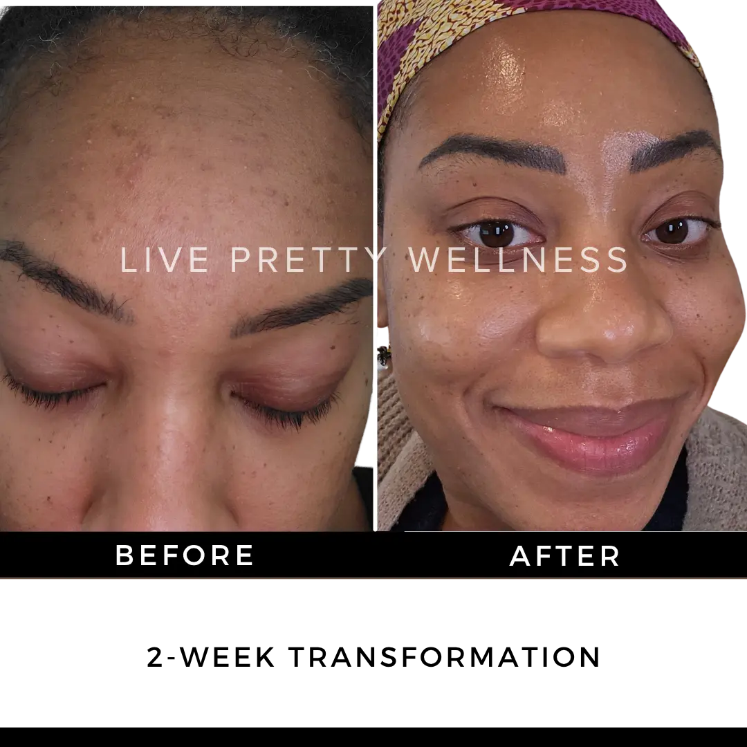 2-Week Transformation