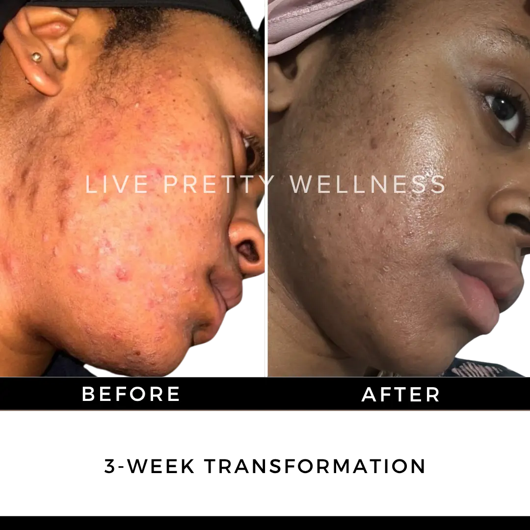 3-Week Transformation