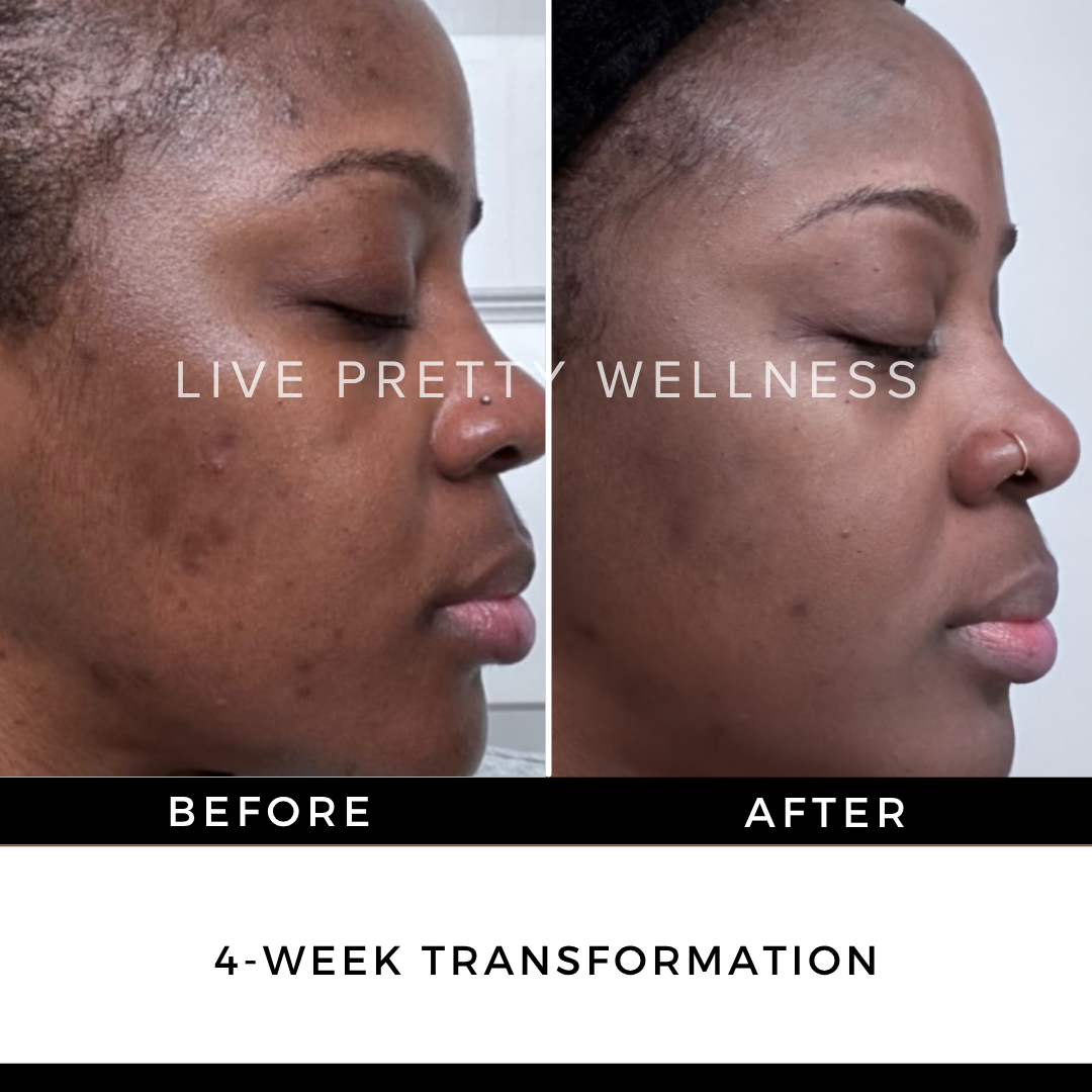 4-Week Transformation